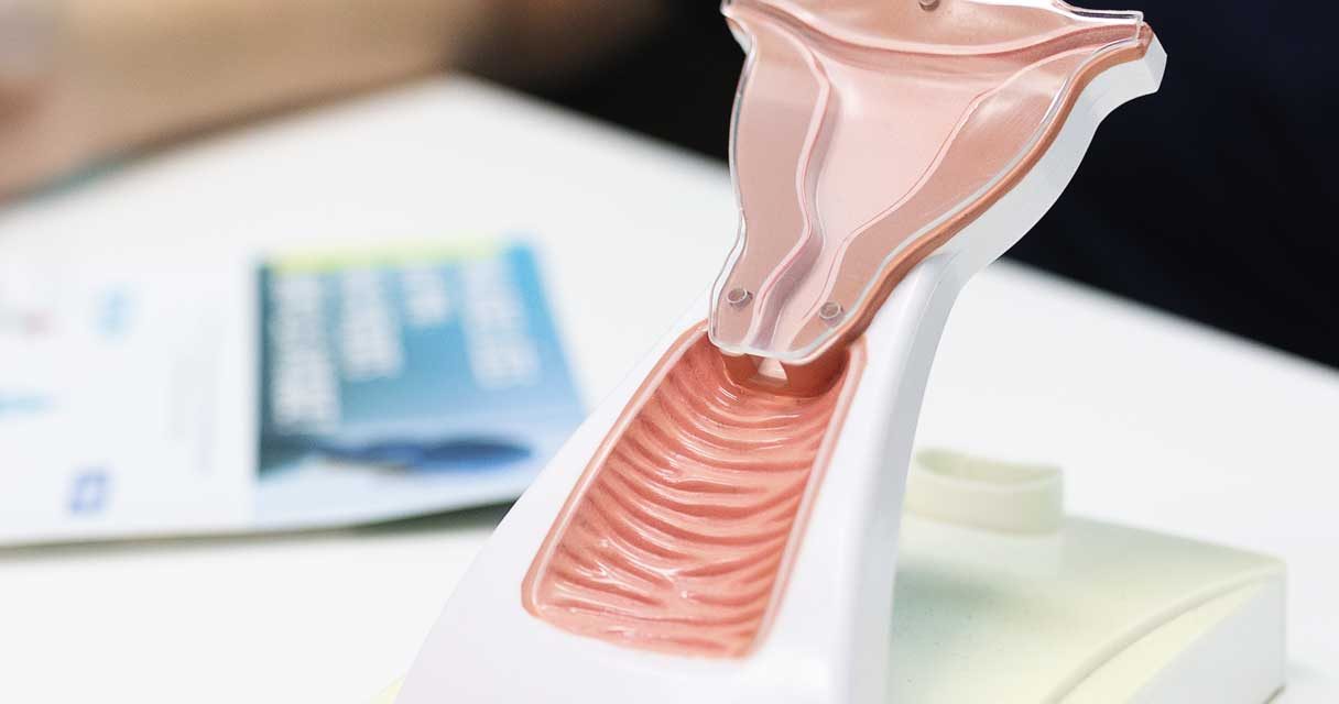 Le dépistage du VPH : un geste préventif essentiel