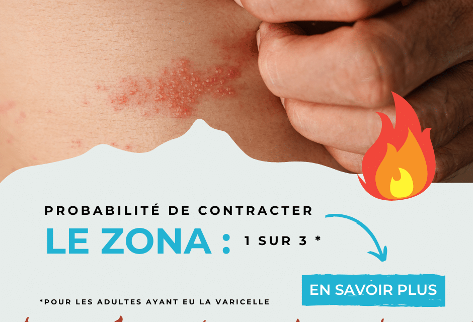 Zona : mieux vaut prévenir… mais aussi agir vite